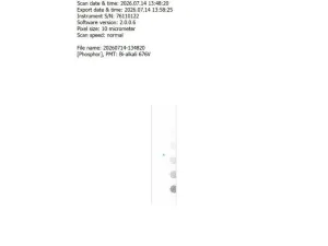 GE Cytiva Amersham Typhoon IP Phosphor Imaging FLA Scanner with Image Eraser, 5 of 20