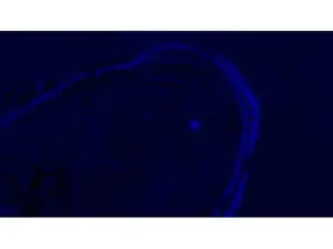 Olympus BX63 Upright Fluorescence Motorized Microscope BX63F with New Fluorescence Filters, 20 of 61