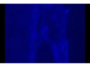 Zeiss AXIO Observer Z1 Inverted Fluorescence Motorized Microscope with Automated XY Stage and Multi-Channel Fluorescence, 11 of 19