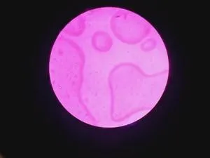 Carl Zeiss Jenamed 2 Microscope with 5 Objectives, 6 of 18