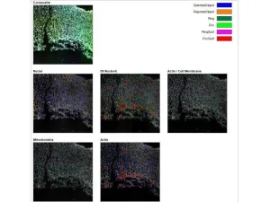 Thermo Scientific CellInsight CX7 LZR Pro High Content Confocal Analysis Platform, 6 of 24