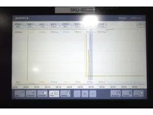 Sartorius Biostat B Dual Control Jacketed Autoclavable Bioreactor System for Microbial Cultures, 2L Vessels, 18 of 48