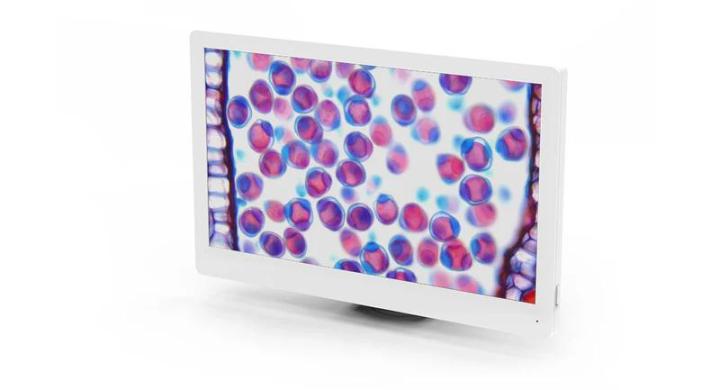 Tucsen Retina Screen 11.6" Heads-Up Microscope Display-cover