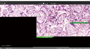 Motic Easystitch Pro Software and Moticam Pro S5 Lite Camera with Panthera C2 Trinocular Microscope Bundle, 2 of 3