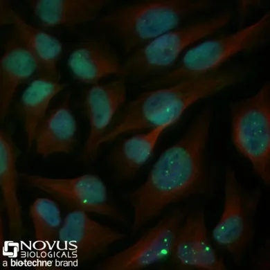Novus Biologicals NB100-304
