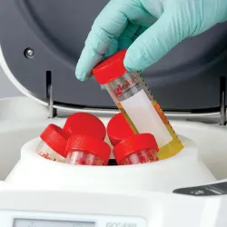 Globe Scientific GCC-E Enhanced Clinical Benchtop Centrifuge with Fixed-Angle Rotor, 5 of 21