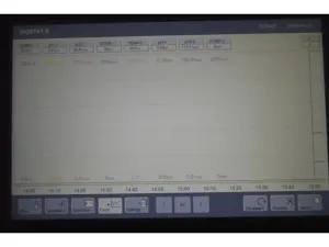 Sartorius Stedim Biostat B Twin Bioreactor with 2-Liter Autoclavable Glass SW Vessels, 6 of 33