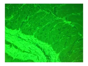Zeiss AXIO Observer Z1 Inverted Fluorescence Motorized Microscope with Automated XY Stage and Multi-Channel Fluorescence, 12 of 19