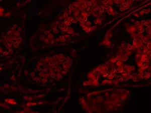 Thermo Scientific CellInsight CX7 LZR High-Content Confocal Analysis Platform with Orbitor RS2 Microplate Mover and Pred Pro, 6 of 24