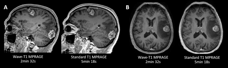 Siemens MPRAGE-cover