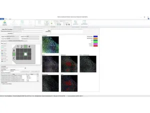 Thermo Scientific CellInsight CX7 LZR Pro High Content Confocal Analysis Platform, 5 of 24