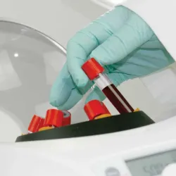 Globe Scientific GCC-P Portable Clinical Centrifuge with Fixed-Angle Rotor and 12VDC Power Adapter, 14 of 23