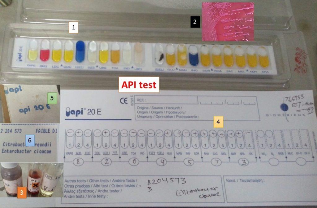 bioMérieux API 20E