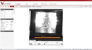 UVP Biospectrum AC Fluorescence and Chemiluminescent Gel Imaging System with CCD Camera, 12 of 22