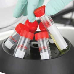 Globe Scientific GCC-P Portable Clinical Centrifuge with Fixed-Angle Rotor and 12VDC Power Adapter, 7 of 23