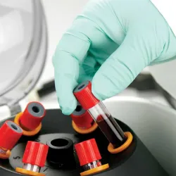 Globe Scientific GCC-P Portable Clinical Centrifuge with Fixed-Angle Rotor and 12VDC Power Adapter, 13 of 23