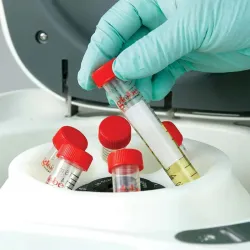 Globe Scientific GCC-E Enhanced Clinical Benchtop Centrifuge with Fixed-Angle Rotor, 4 of 21