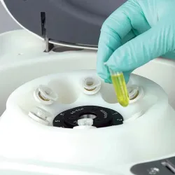 Globe Scientific GCC-E Enhanced Clinical Benchtop Centrifuge with Fixed-Angle Rotor, 6 of 21
