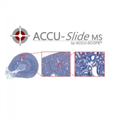 Accu-Scope ACCU-SlideMS Manual Slide Scanning System with Sony IMX249 Camera