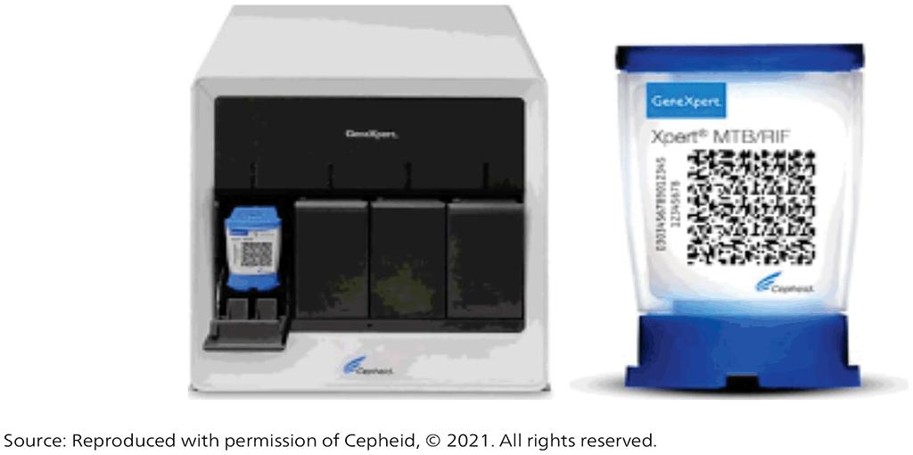 Cepheid Xpert MTB/RIF