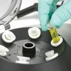 Globe Scientific GCC-P Portable Clinical Centrifuge with Fixed-Angle Rotor and 12VDC Power Adapter, 11 of 23