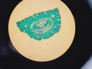 Zeiss PALM Microbeam System with Observer.Z1 Microscope and XL-PALM Incubator, 5 of 102