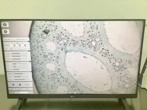 Accu Scope EXI-310 Inverted Phase Contrast Microscope with TrueChrome Metrics Camera, 9 of 13