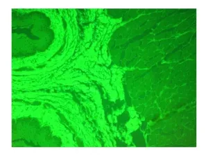 Olympus IX71 Inverted Fluorescence Phase Contrast Microscope with New Fluorescence Filters, 13 of 18