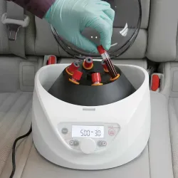 Globe Scientific GCC-P Portable Clinical Centrifuge with Fixed-Angle Rotor and 12VDC Power Adapter, 8 of 23