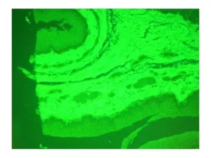 Olympus BX51 Upright Fluorescence Microscope with Mechanical Stage and Advanced Imaging Capability, 10 of 16