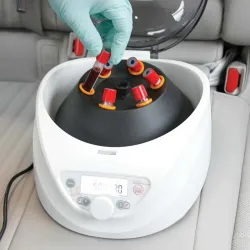 Globe Scientific GCC-P Portable Clinical Centrifuge with Fixed-Angle Rotor and 12VDC Power Adapter, 9 of 23